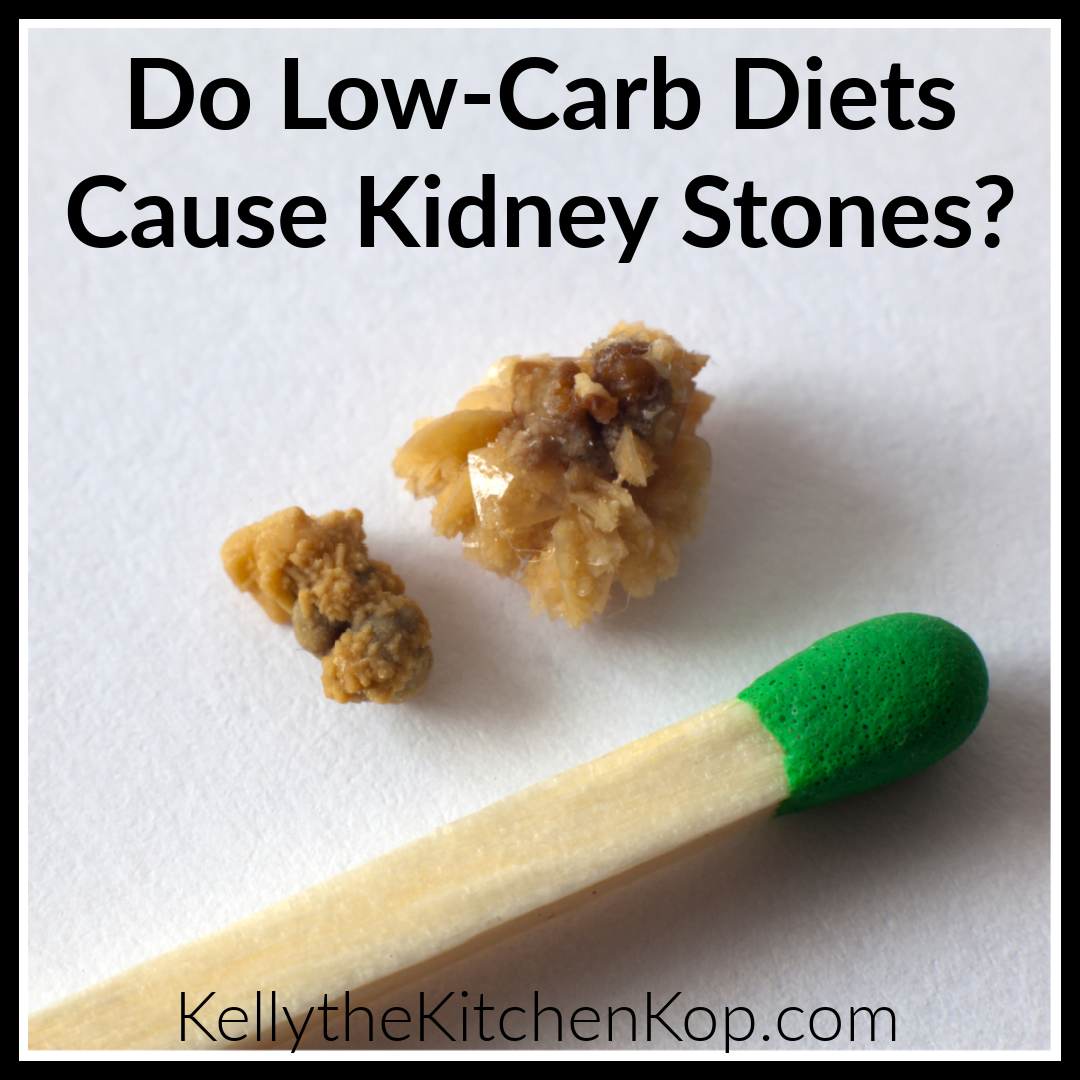 do-low-carb-diets-cause-kidney-stones