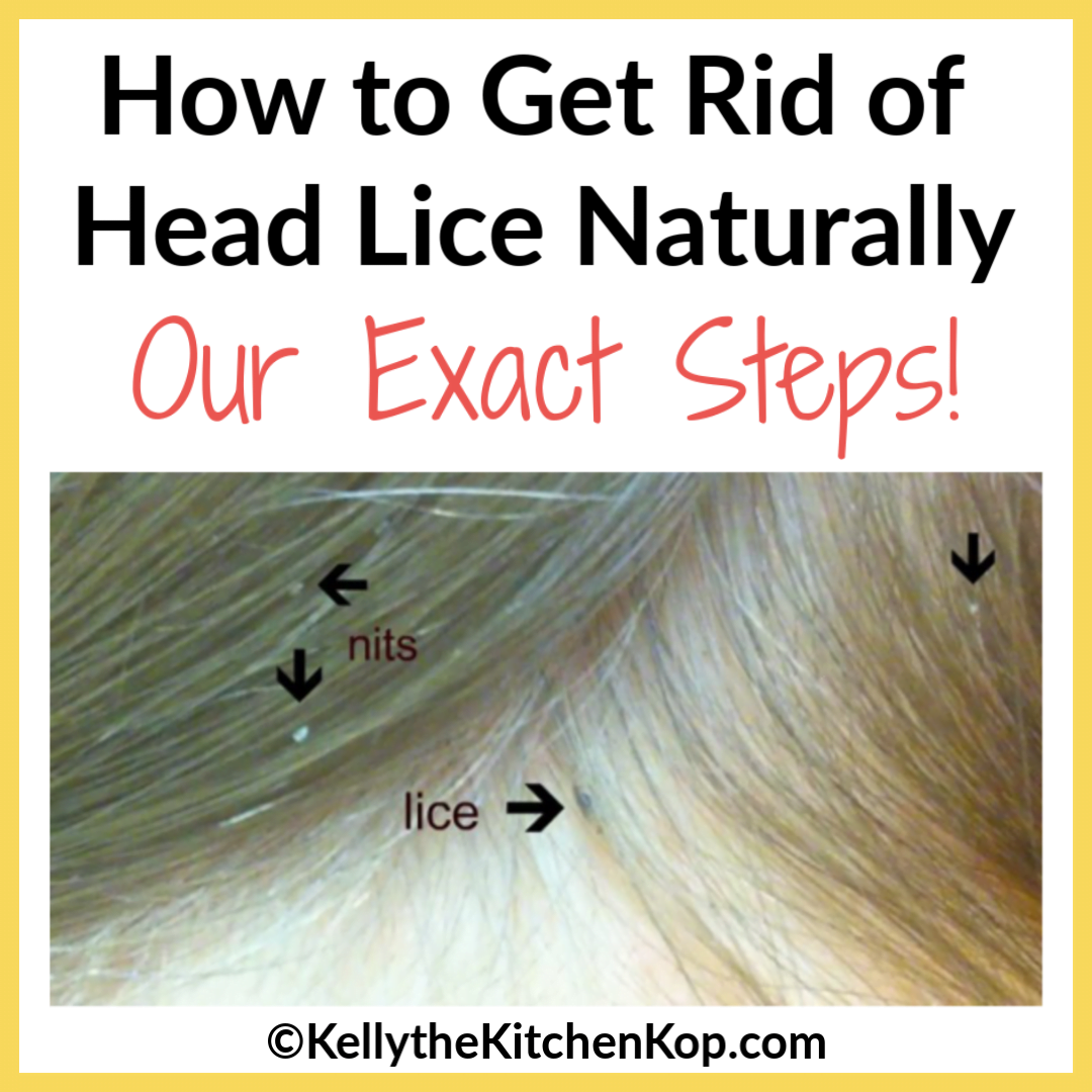 How to get rid of head lice naturally - Kelly the Kitchen Kop