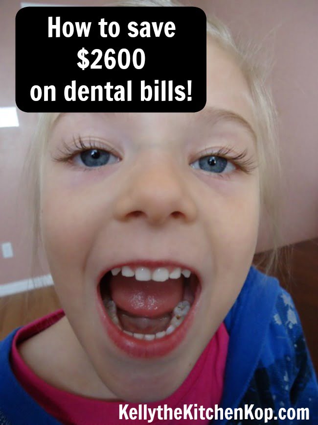How to Save on Dental Bills
