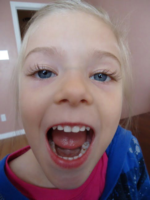 How to Save on Dental Bills