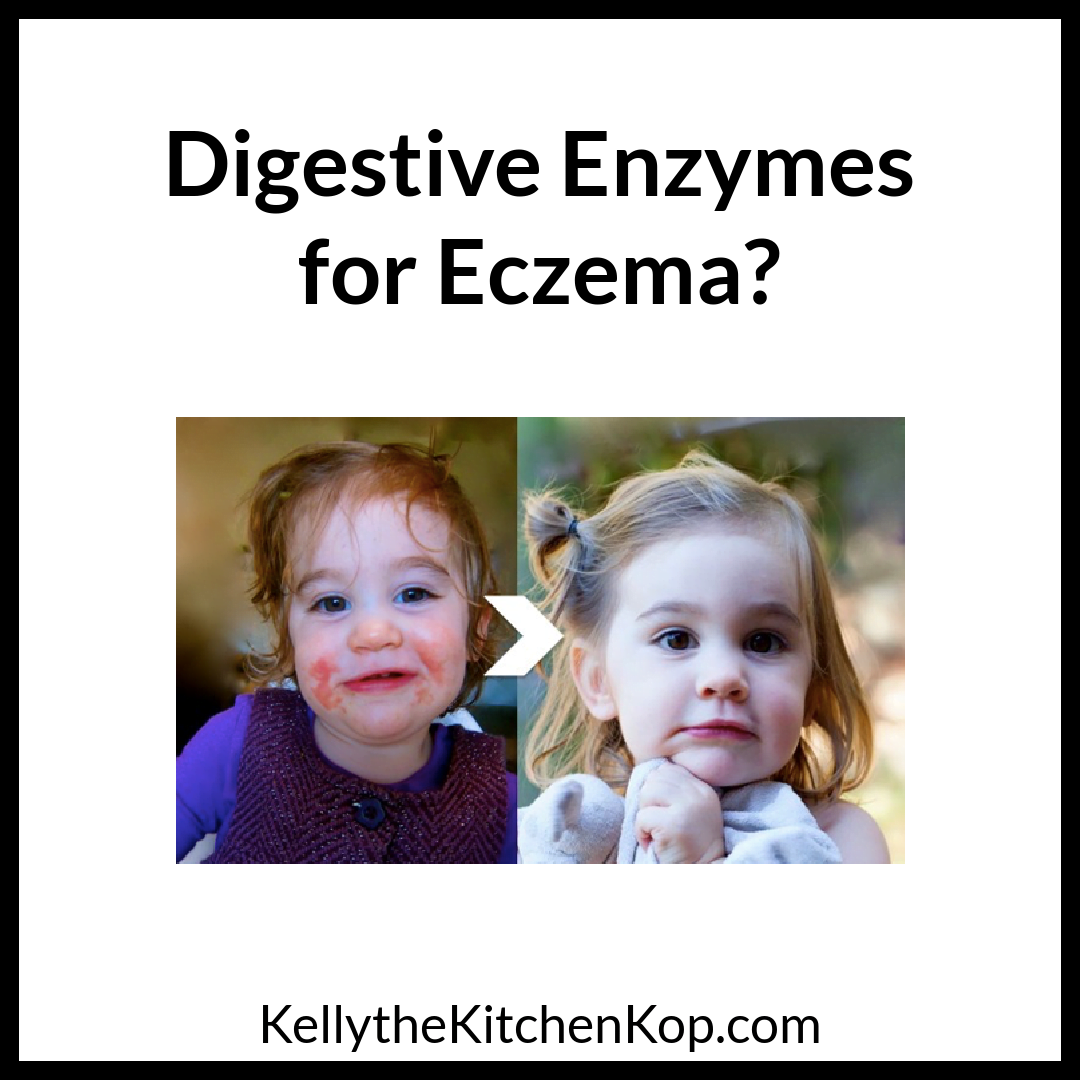 Digestive Enzymes for Eczema