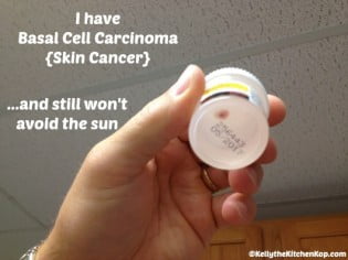 basal cell carcinoma skin cancer