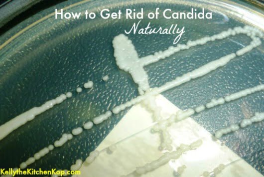 How to Get Rid of Candida Naturally