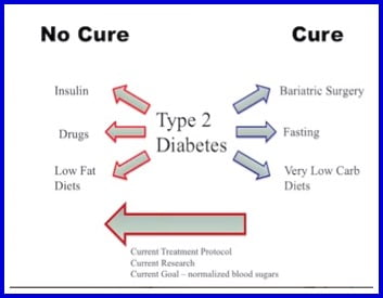 Reversing diabetes naturally - cure