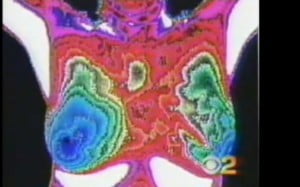 thermography