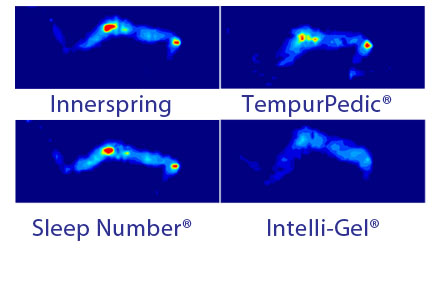 Intellibed pressure map