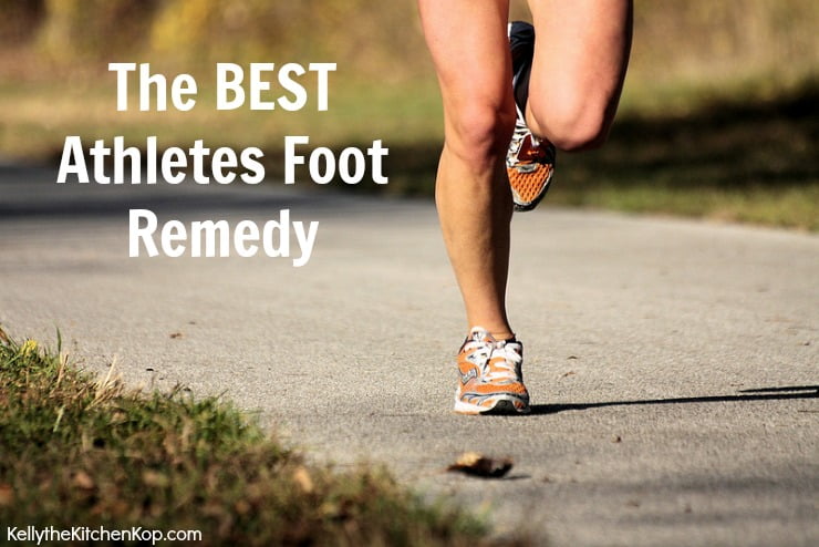 BEST Athletes Foot Remedy