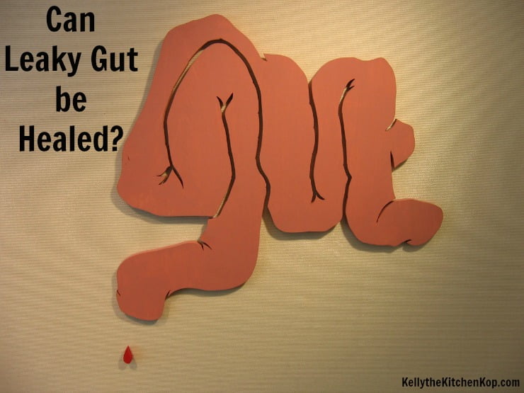 Can Leaky Gut be Healed