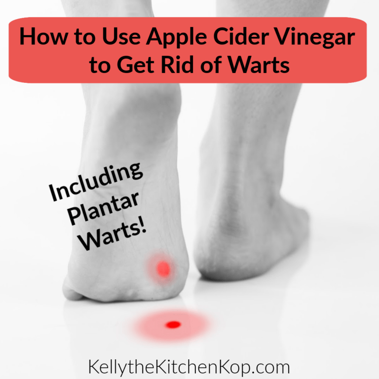 How to Use Apple Cider Vinegar to Remove Warts Kelly the Kitchen Kop