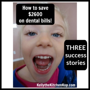 How to Save on Dental Bills